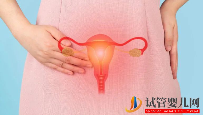 子宮內(nèi)膜異位癥的自我護理技巧(圖1)