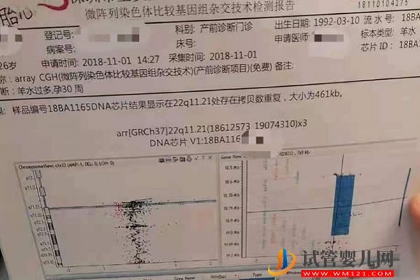 第一胎2號染色體異常并非不能要孩子，能否要二胎看情況(圖2)