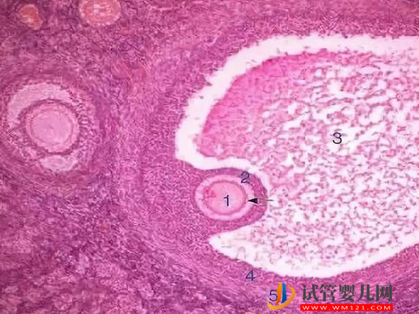 促排空卵泡能否長大到成熟并自然排除(圖1)