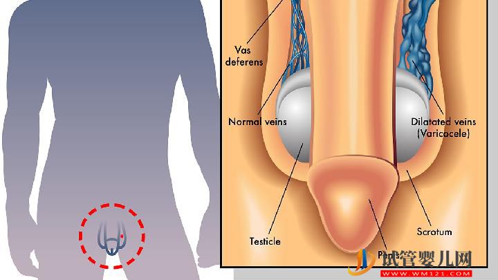 引發男性不育的原因有哪些？4大生活惡習易致不育(圖2)