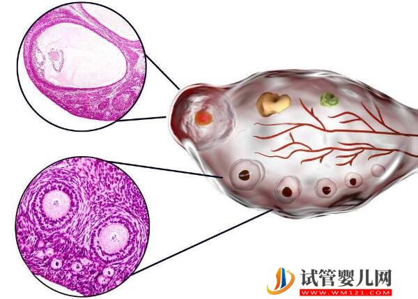 去老撾做試管嬰兒過程痛苦嗎？(圖2)