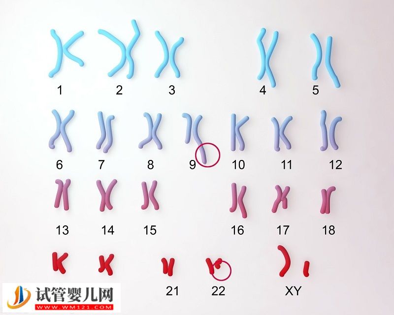 22號(hào)染色體缺失能做三代試管嗎(圖1)