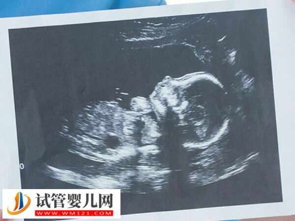 上海集愛醫(yī)院助孕步驟分享，掛號到驗(yàn)孕流程匯總(圖1)