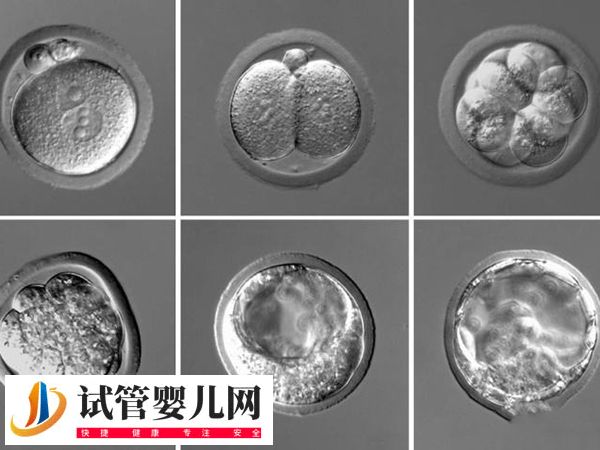 在美國(guó)做試管優(yōu)質(zhì)胚胎是啥樣的(圖3)