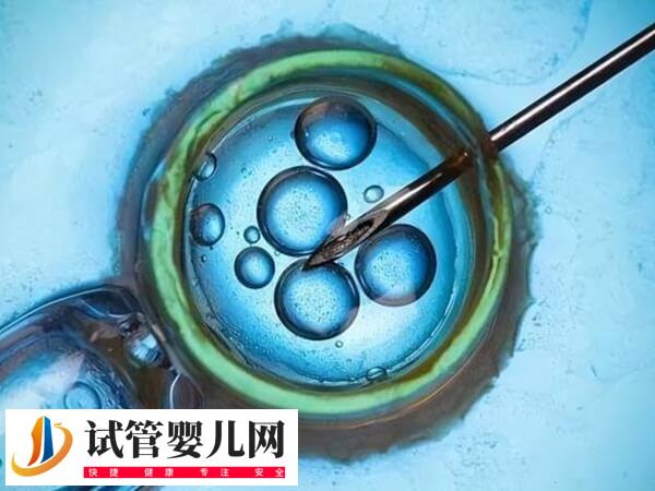 謹慎移植的成功率有多少