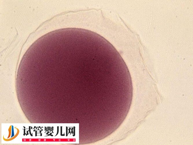 胚胎輔助孵化技術(shù)安不安全