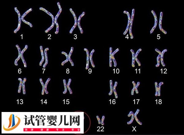 22號(hào)染色體異常會(huì)有哪些遺傳病(圖2)