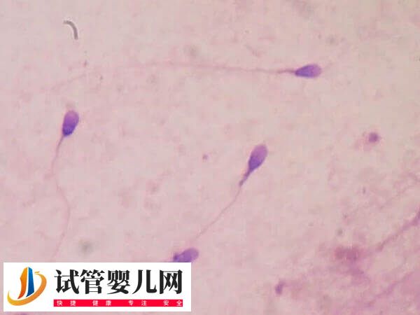 女性骨髓造精多少錢