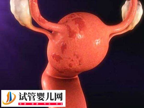 子宮內膜容受性什么意思